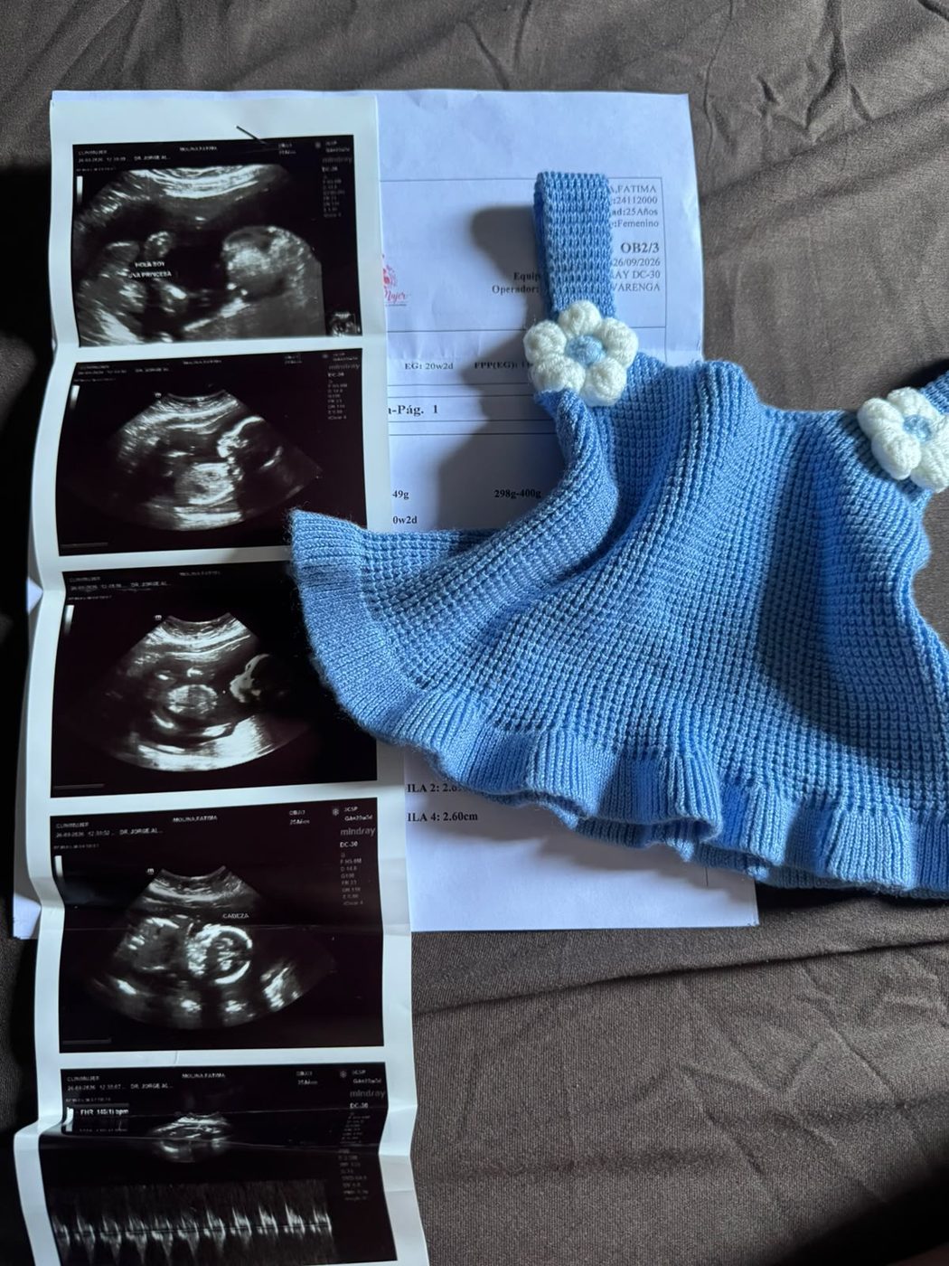 Foto de ultrasonido y ropita de bebé